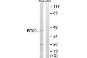 Western blot analysis of extracts from A549 cells, using MRPS9 Antibody. (MRPS9 抗体  (AA 91-140))