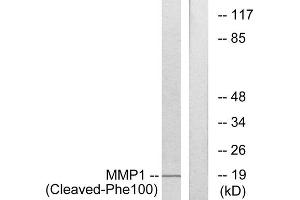 Western blot analysis of extracts from 549 cells, treated with etoposide (25uM, 24hours), using MMP1 (Cleaved-Phe100) antibody. (MMP1 抗体  (Cleaved-Phe100))