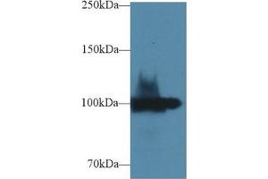 Western Blot; Sample: Rat Kidney lysate; Primary Ab: 1µg/ml Rabbit Anti-Rat ENPP1 Antibody Second Ab: 0. (ENPP1 抗体  (AA 568-793))