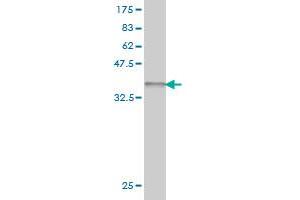 Western Blot detection against Immunogen (37. (ZNF281 抗体  (AA 787-893))