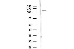 Western blot analysis of lysates from LoVo cells(heat-shock,45 min treatment), using EPH Antibody at 1/1000 dilution.