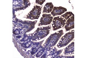IHC testing of FFPE mouse small intestine tissue with GDA antibody at 1ug/ml. (GDA 抗体)