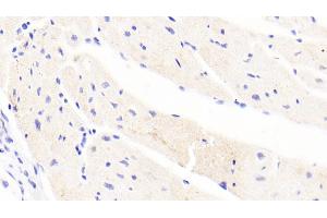 Immunohistochemistry (IHC) image for anti-Hepcidin Antimicrobial Peptide (HAMP) (AA 25-84) antibody (ABIN7434458)