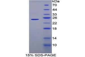 SDS-PAGE analysis of Mouse Adenylate Cyclase 6 Protein. (ADCY6 蛋白)