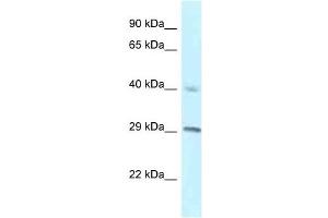 Western Blot showing RCC1 antibody used at a concentration of 1 ug/ml against NCI-H226 Cell Lysate (RCC1 抗体  (C-Term))
