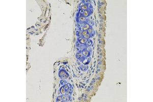 Immunohistochemistry of paraffin-embedded mouse lung using GPHN antibody at dilution of 1:100 (x40 lens). (Gephyrin 抗体)