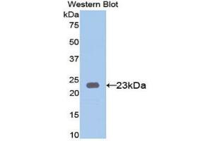 Western Blotting (WB) image for anti-Keratin 23 (KRT23) (AA 243-382) antibody (ABIN1171784) (KRT23 抗体  (AA 243-382))