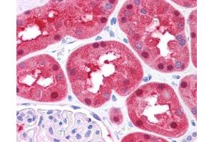 FAH antibody was used for immunohistochemistry at a concentration of 4-8 ug/ml. (FAH 抗体)