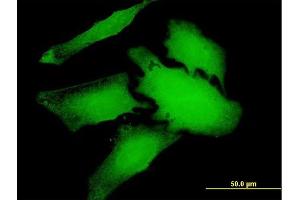 Immunofluorescence of purified MaxPab antibody to WDR66 on HeLa cell. (WDR66 抗体  (AA 1-946))