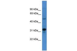 Image no. 1 for anti-Transmembrane Protein 176B (TMEM176B) (C-Term) antibody (ABIN6745490) (TMEM176B 抗体  (C-Term))