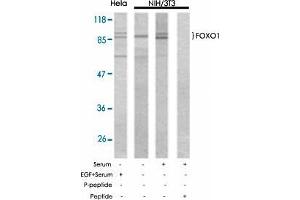 Western blot analysis of extract from Hela and NIH/3T3 using FOXO1 polyclonal antibody  . (FOXO1 抗体)