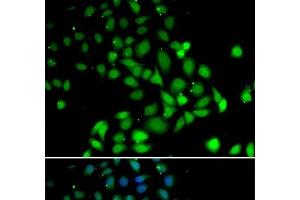Immunofluorescence analysis of U2OS cells using PARN Polyclonal Antibody (PARN 抗体)