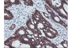 Image no. 6 for anti-Aminoacylase 1 (ACY1) antibody (ABIN1496455)