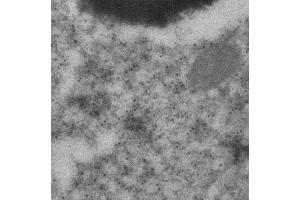 Immunogold labeling of epithelium cells (GFP 抗体)