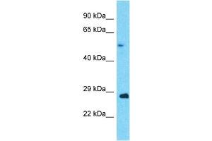 Host:  Rabbit  Target Name:  ANAPC5  Sample Type:  Ovary Tumor lysates  Antibody Dilution:  1. (ANAPC5 抗体  (Middle Region))
