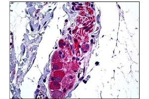 Human Intestine, Ganglion Cells: Formalin-Fixed, Paraffin-Embedded (FFPE) (HDAC6 抗体  (N-Term))