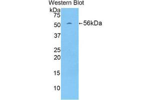 Western Blotting (WB) image for anti-Protein L-Myc (MYCL) (AA 186-439) antibody (ABIN1859918) (LMYC 抗体  (AA 186-439))