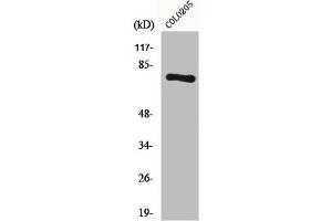 Western Blot analysis of COLO205 cells using HLX1 Polyclonal Antibody (HLX 抗体  (C-Term))