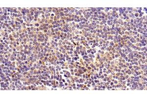 Immunohistochemistry (IHC) image for anti-Kynurenine 3-Monooxygenase (Kynurenine 3-Hydroxylase) (KMO) (AA 1-374) antibody (ABIN7436537)