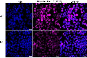 Immunocytochemical staining of HeLa cells using Phospho-Rad17 (S656) antibody (ABIN7800113), 1:1,000), Top panel: wild-type (WT), Bottom panal: Phospho-Rad17 (S656) shRNA knockdown (KD). (Recombinant RAD17 抗体  (pSer656))