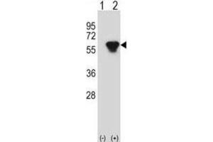 Western Blotting (WB) image for anti-Protein Kinase, CAMP-Dependent, Regulatory, Type II, beta (PRKAR2B) antibody (ABIN2998379) (PRKAR2B 抗体)
