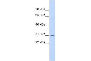 NFKBIA antibody (70R-10440) used at 0. (NFKBIA 抗体  (N-Term))