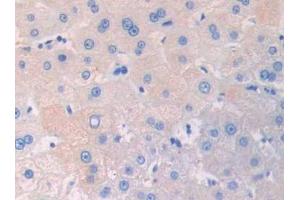 Used in DAB staining on fromalin fixed paraffin- embedded kidney tissue (IL3RA 抗体  (AA 19-158))