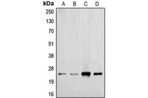 Western blot analysis of TGF beta 2 expression in MCF7 (A), HeLa (B), mouse kidney (C), rat placenta (D) whole cell lysates. (TGFB2 抗体  (C-Term))