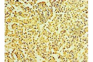 Immunohistochemistry of paraffin-embedded human spleen tissue using ABIN7156877 at dilution of 1:100 (IL27 Receptor alpha 抗体  (AA 33-283))