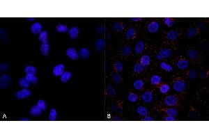 Immunocytochemistry (ICC) image for anti-Vacuolar Protein Sorting 35 (VPS35) antibody (Biotin) (ABIN6932968)