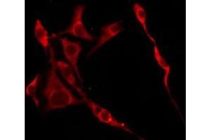 Immunofluorescence (fixed cells) (IF/ICC) image for anti-Olfactory Receptor, Family 10, Subfamily R, Member 2 (OR10R2) (C-Term) antibody (ABIN6258880)