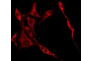 ABIN6276245 staining HeLa by IF/ICC. (OR10R2 抗体  (C-Term))