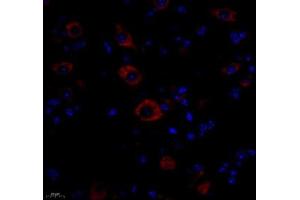 Immunofluorescence of paraffin embedded mouse spinal cord using NACAD (ABIN7074756) at dilution of 1:650 (400x lens) (NACAD 抗体)