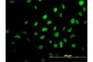 Immunofluorescence of monoclonal antibody to TRIM36 on HeLa cell. (TRIM36 抗体  (AA 391-499))