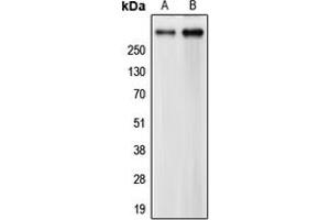 Western blot analysis of CEP290 expression in HeLa (A), CCRFCEM (B) whole cell lysates. (CEP290 抗体  (Center))