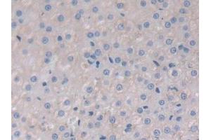 Immunohistochemistry (IHC) image for anti-Mitogen-Activated Protein Kinase 8 (MAPK8) (AA 138-370) antibody (ABIN7439327)