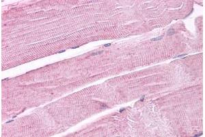 Anti-PTPRA antibody IHC staining of human skeletal muscle. (PTPRA 抗体  (Cytoplasmic Domain))