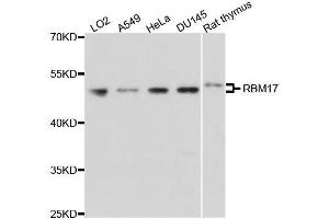 Western blot analysis of extracts of various cell lines, using RBM17 antibody. (RBM17 抗体  (AA 1-240))
