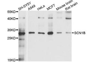 Western blot analysis of extracts of various cells, using SCN1B antibody. (SCN1B 抗体)