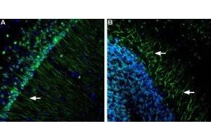 Expression of Presenilin-1 in mouse brain - Immunohistochemical staining of mouse hippocampus and mouse cerebellum using Anti-Presenilin-1 Antibody (ABIN7043552, ABIN7044524 and ABIN7044525), (1:600). (Presenilin 1 抗体  (AA 345-359))