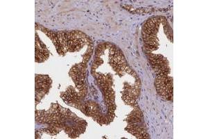 Immunohistochemical staining of human prostate with UFM1 polyclonal antibody  shows strong cytoplasmic positivity in glandular cells. (UFM1 抗体)