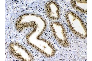 Immunohistochemistry (IHC) image for anti-X-Ray Repair Complementing Defective Repair in Chinese Hamster Cells 1 (XRCC1) (AA 538-633) antibody (ABIN5693138)
