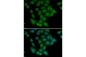Immunofluorescence analysis of U20S cell using CAMK1 antibody. (CAMK1 抗体)