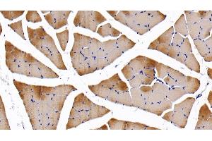 Detection of TNNI2 in Rat Skeletal muscle Tissue using Polyclonal Antibody to Troponin I Type 2, Fast Skeletal (TNNI2) (TNNI2 抗体  (AA 1-182))