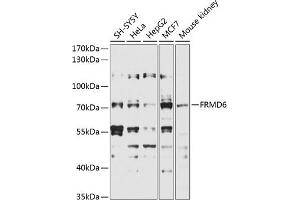 Western blot analysis of extracts of various cell lines, using FRMD6 antibody (ABIN6132194, ABIN6140773, ABIN6140774 and ABIN6225347) at 1:1000 dilution. (FRMD6 抗体  (AA 405-614))