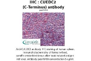Image no. 2 for anti-CUE Domain Containing 2 (CUEDC2) (C-Term) antibody (ABIN1733372) (CUEDC2 抗体  (C-Term))