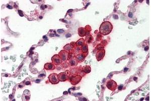 Human Lung (formalin-fixed, paraffin-embedded) stained with CLU antibody ABIN364331 at 10 ug/ml followed by biotinylated anti-mouse IgG secondary antibody ABIN481714, alkaline phosphatase-streptavidin and chromogen. (Clusterin 抗体  (AA 1-333))
