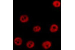 ABIN6267631 staining HT29 by IF/ICC. (PRKAA1 抗体  (pSer486))