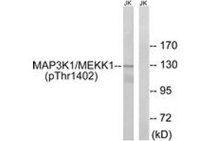Western blot analysis of extracts from Jurkat cells, using MAP3K1 (Phospho-Thr1402) Antibody. (MAP3K1 抗体  (pThr1402))