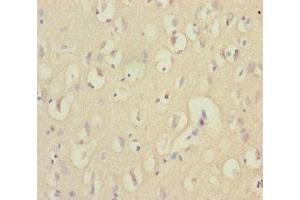 Immunohistochemistry of paraffin-embedded human brain tissue using ABIN7151538 at dilution of 1:100 (EEF1A2 抗体  (AA 184-463))